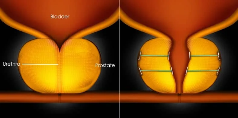 Solar Panles